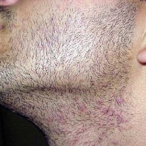 barba accorciata barba accorciata